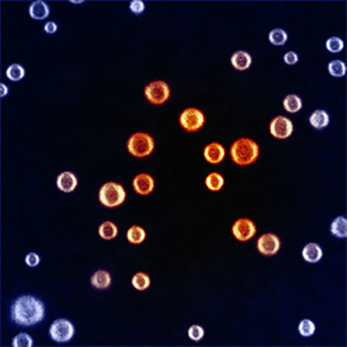 Fluorescent-microscope image of air-filled microbubbles labelled with Rhodamine (image size 40 μm x 40 μm)